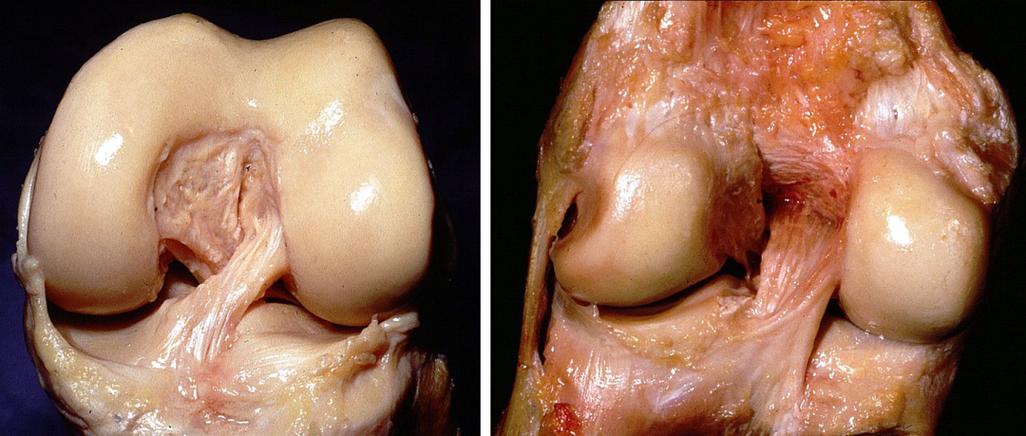 TA：库卢塞夫斯基接受膝关节镜手术，不再为自己设定具体复出时间